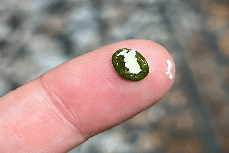 تغییر رنگ مدفوع به رنگ سبز یا زرد از علائم عفونت روده